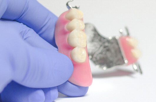Picture of partial dentures