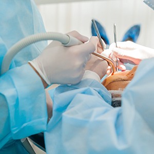 Dental implant surgery in Lebanon
