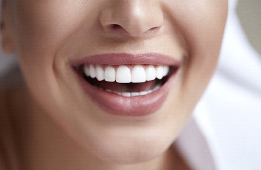 Closeup of beautiful smile after smile makeover in Lebanon