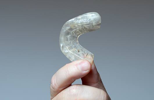 Hand holding an occlusal splint appliance for T M J therapy